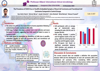 The Prevalence of SV40 Virus in Paraffin-Embedded Samples of Renal Cell Carcinoma and Transitional Cell Carcinoma Compared to Control Groups 